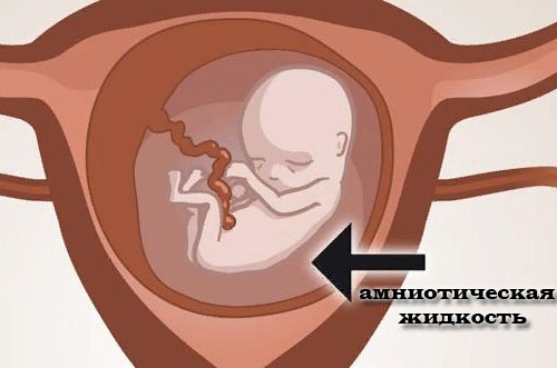 Как отходят воды у беременных перед родами. Признаки, как выглядит, какого цвета у перво-, повторнородящих. Подтекание околоплодных вод