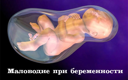 Как отходят воды у беременных перед родами. Признаки, как выглядит, какого цвета у перво-, повторнородящих. Подтекание околоплодных вод