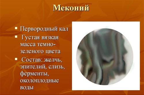 Как отходят воды у беременных перед родами. Признаки, как выглядит, какого цвета у перво-, повторнородящих. Подтекание околоплодных вод