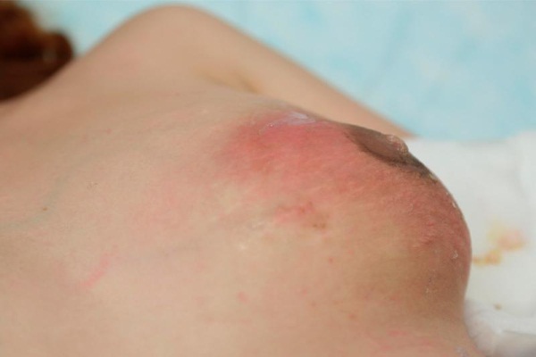 Как правильно прикладывать ребенка к груди при кормлении. Видео, фото, как научиться