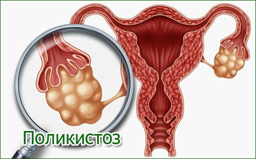 Как подготовить организм к беременности после 25, 30, 40 лет, болезни. С чего начать