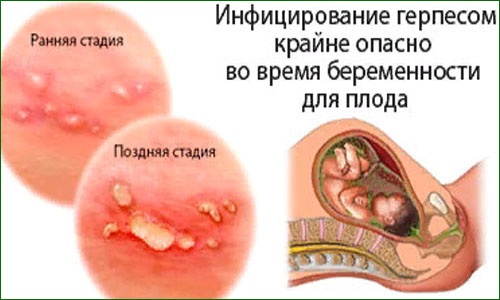 Как подготовить организм к беременности после 25, 30, 40 лет, болезни. С чего начать