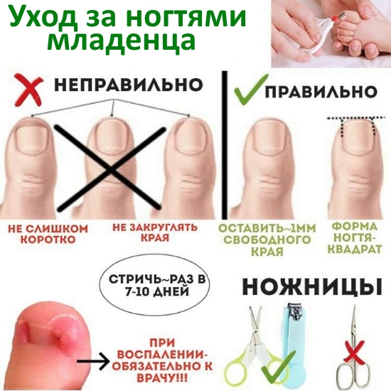 Как подстричь ногти новорожденному, когда первый раз, чем, чтобы не было вросших ногтей, уход