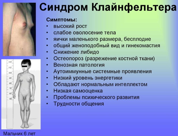 Индекс массы тела (ИМТ) у женщин, мужчин, детей. Что это такое, как считать по возрасту и росту, формула