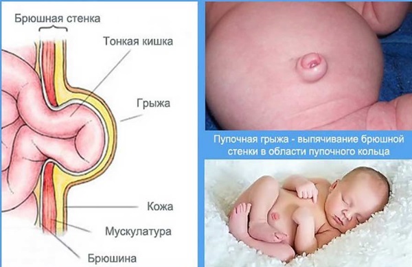 Как правильно выкладывать новорожденного на животик перед кормлением, при коликах