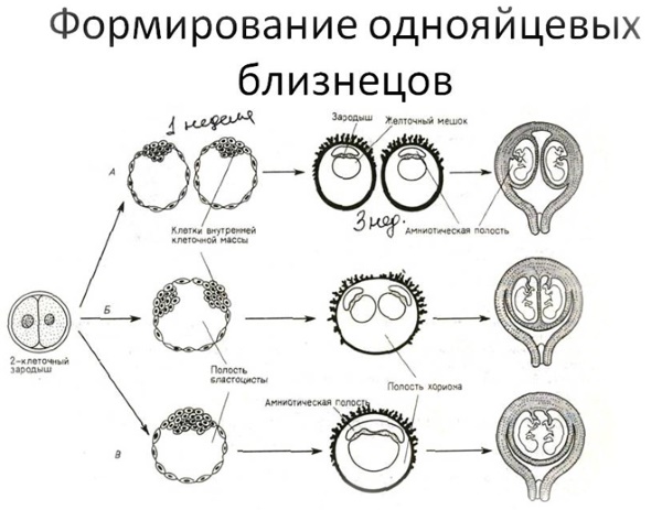 Как забеременеть двойней. Особенности, как получается двойня, многоплодная беременность