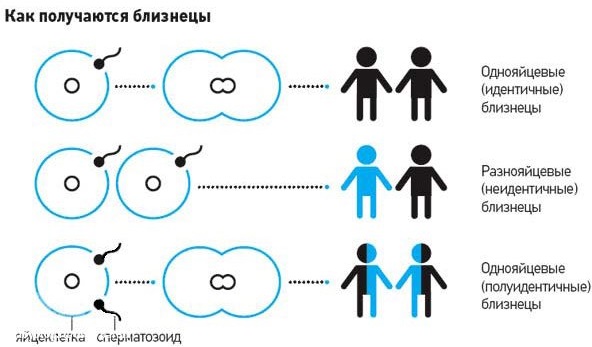 Как забеременеть двойней. Особенности, как получается двойня, многоплодная беременность