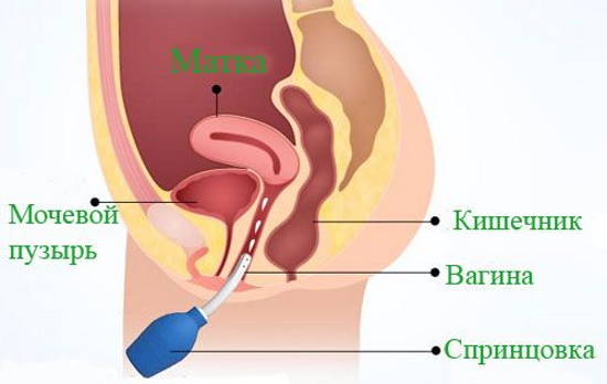 Как зачать девочку 100 процентов. Калькулятор по месяцу, крови, овуляции