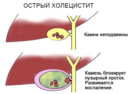 Кесарево сечение: плюсы и минусы для ребенка и мамы. Показания, последствия, восстановление. Советы и мнения специалистов