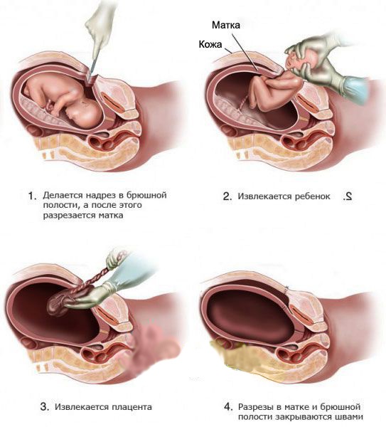 Млечный путь для лактации. Инструкция по применению, цена, отзывы