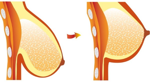 Когда можно заниматься спортом после родов кормящей маме: после разрывов, эпизиотомии, кесарева. Спорт для укрепления здоровья и похудения женщины