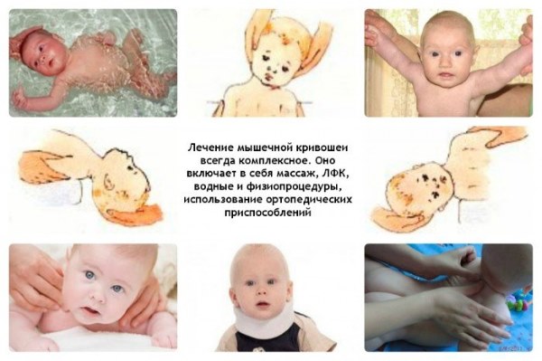 Когда ребенок начинает держать голову