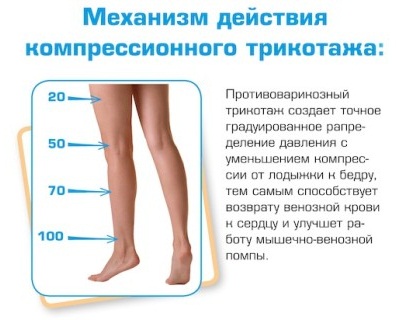 Компрессионные чулки для беременных женщин. Классы, виды, как выбрать размер, надевать, сколько носить, где купить. Лучшие бренды