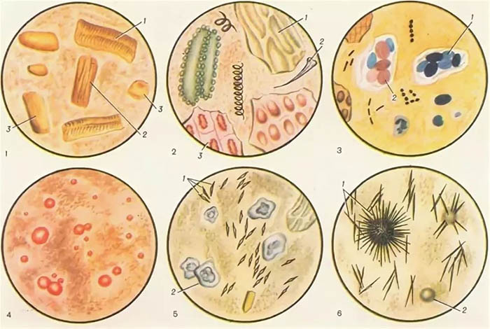 Копрограмма у детей. Что это за анализ, норма, расшифровка