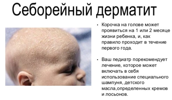 Корочки на голове у грудничка, ребенка 2-3 года. Себорейные, молочные, желтые, белые. Как убрать, вычесать, быстро избавиться в домашних условиях