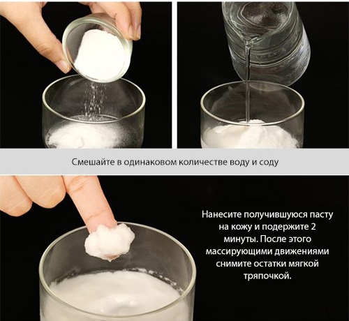 Корочки на голове у грудничка, ребенка 2-3 года. Себорейные, молочные, желтые, белые. Как убрать, вычесать, быстро избавиться в домашних условиях