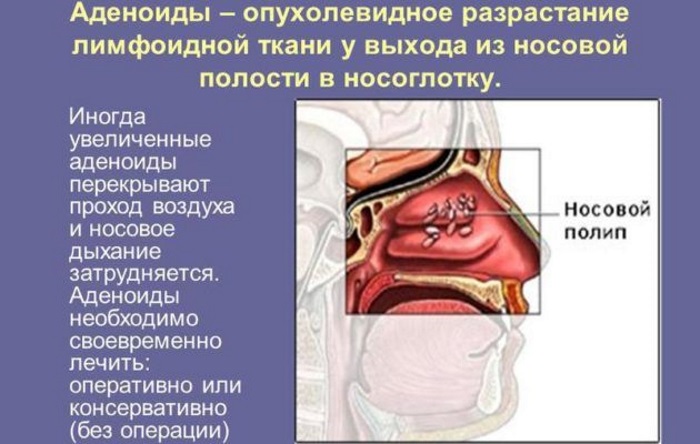 Красные круги под глазами у ребенка. Причины красноты и припухлости. Комаровский