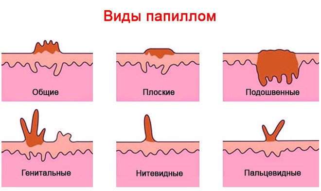 Красные круги под глазами у ребенка. Причины красноты и припухлости. Комаровский