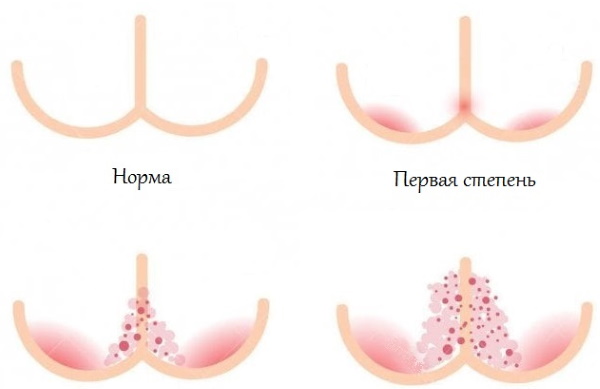 Крем Бепантен для новорожденных. Инструкция по применению, отзывы