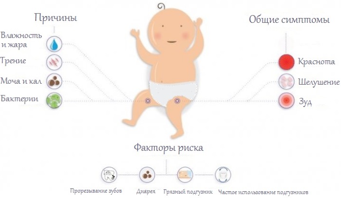 Кремы от опрелостей для новорожденных. Рейтинг, отзывы. Деситин, Бепантен, Судокрем
