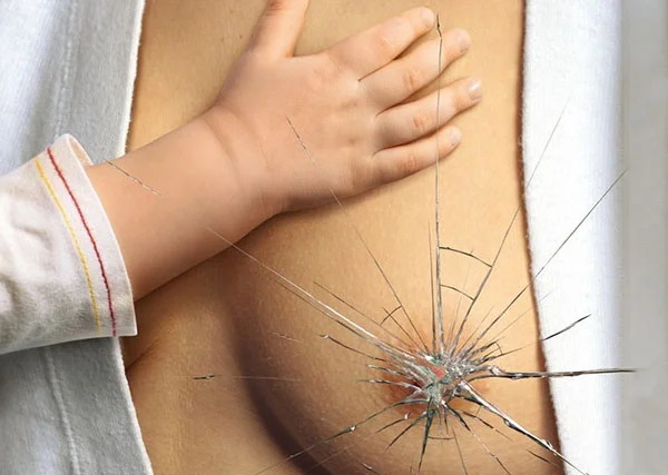 Крем от трещин для кормящих мам: Пурелан, Медела, Бепантен, Авент, Саносан. Инструкции, цены