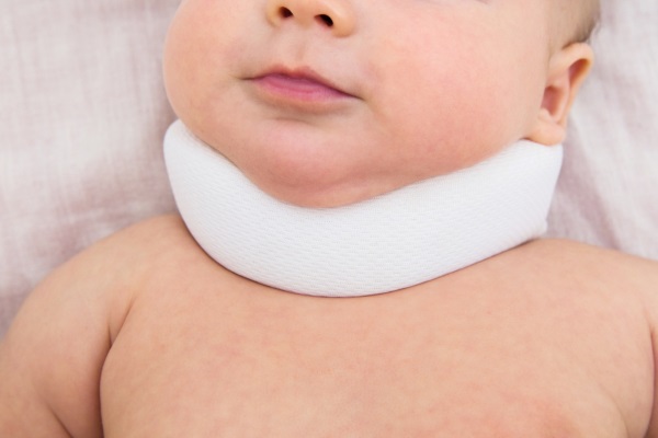 Кривошея у новорожденных. Причины, признаки, фото и лечение