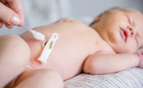 Кровит пупок у новорожденного. Что делать, причины