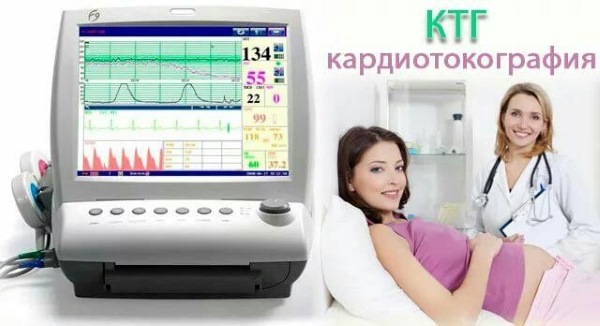 КТГ при беременности: что это, норма, что показывает, расшифровка, когда и сколько делают, как подготовиться