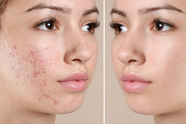 Можно ли курагу при грудном вскармливании?