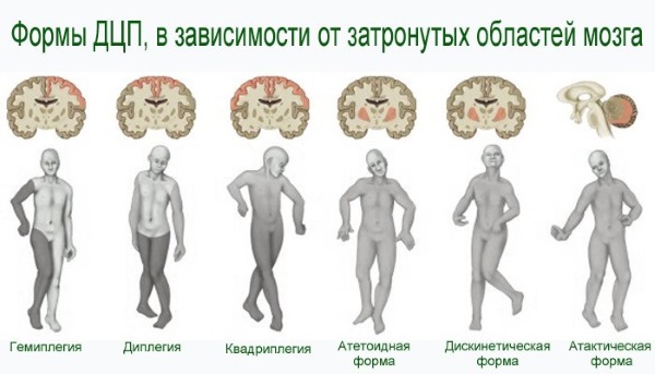 Курение во время беременности. Как влияет плод, пассивное курение на ранних сроках, вред, последствия, отзывы гинекологов