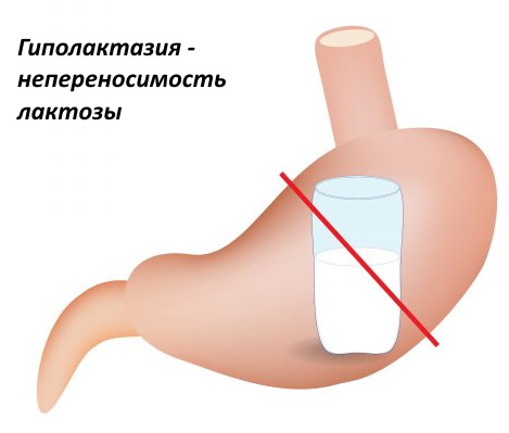 Лактазар для грудничков. Инструкция, как давать при искусственном вскармливании, аналоги, отзывы