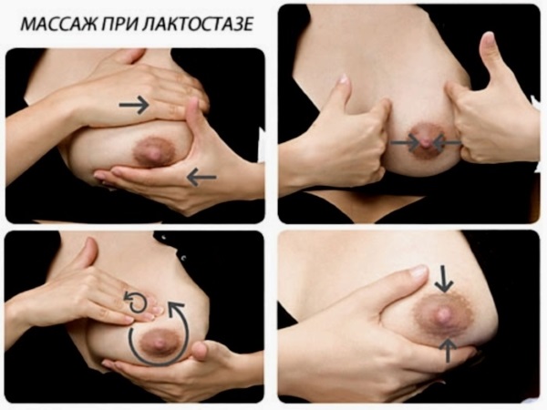 Лактостаз у кормящей матери: симптомы и лечение с температурой и без в домашних условиях