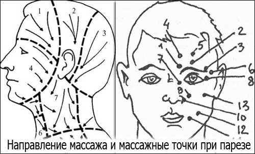 Логопедический массаж для детей в домашних условиях при дизартрии, заикании, ЗРР, ДЦП, моторной алалии, парезе, ФФНР. Обучение, видео