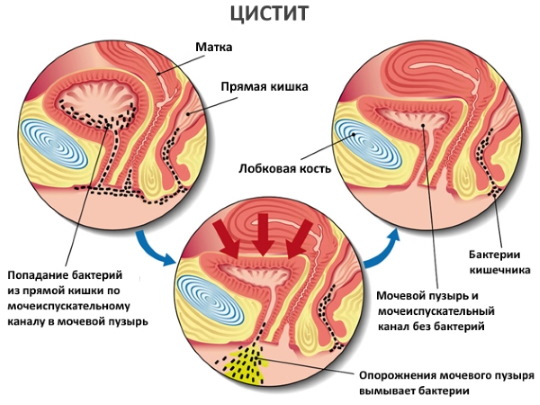 Температура перед месячными может ли быть? За сколько дней поднимается