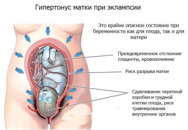 Магний в6 при беременности. Для чего, как принимать, дозировка, аналоги, какой лучше