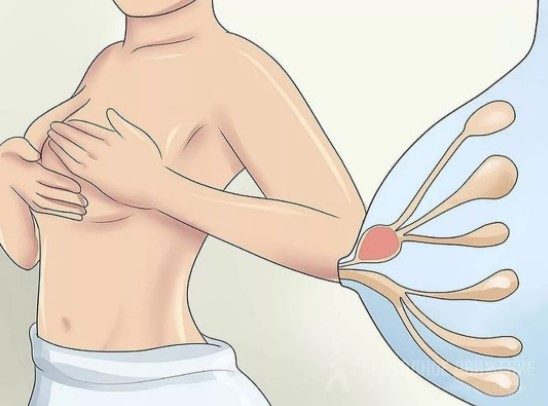 Массаж при лактостазе у кормящих мам. Видео