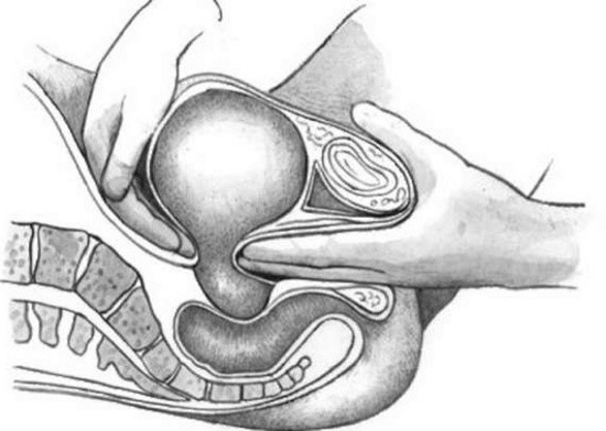 Матка при беременности на ранних сроках на ощупь. Размеры