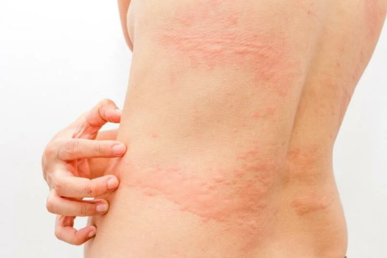 Медела (Medela) крем от трещин. Инструкция по применению, цена, отзывы