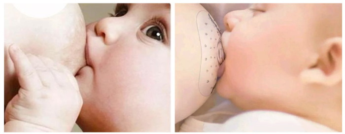 Медела (Medela) накладки для грудного вскармливания. Инструкция, размеры, где купить, как надеть, цены