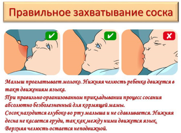 Медела (Medela) накладки для грудного вскармливания. Инструкция, размеры, где купить, как надеть, цены