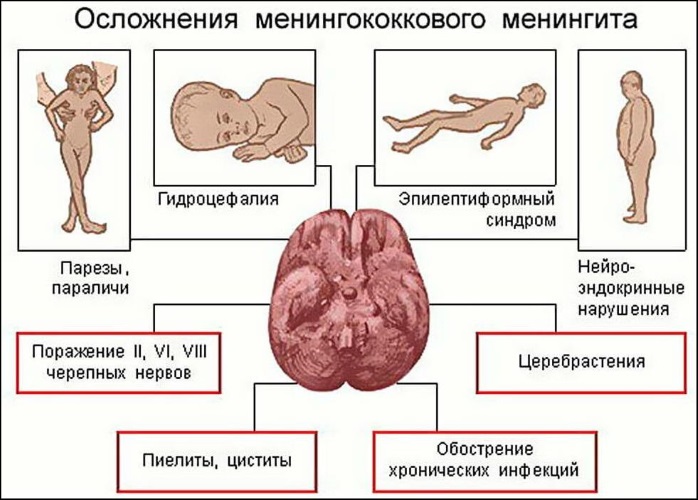 Менингококковая инфекция у детей. Симптомы начальная стадия. Лечение антибиотиками, инкубационный период. Прививка, название вакцины