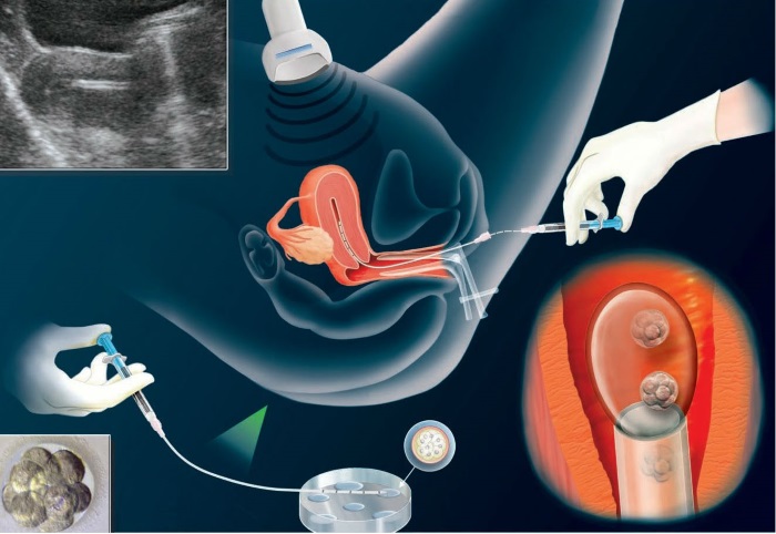 Месячные при беременности на ранних сроках – причины, как идут, как отличить о обычных