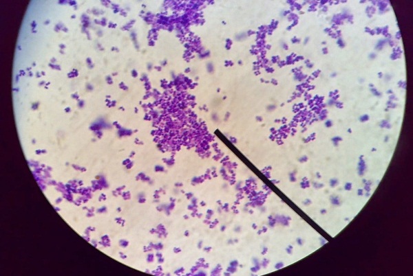 Микробы под микроскопом. Фото на руках, во рту, под ногтями. Какие бывают, как выглядят, презентация для детей