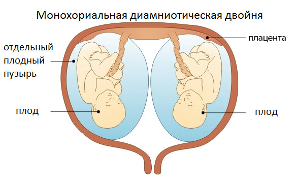 Монохориальная диамниотическая двойня. Что это такое, близнецы или двойняшки, развитие по неделям, как проходят роды