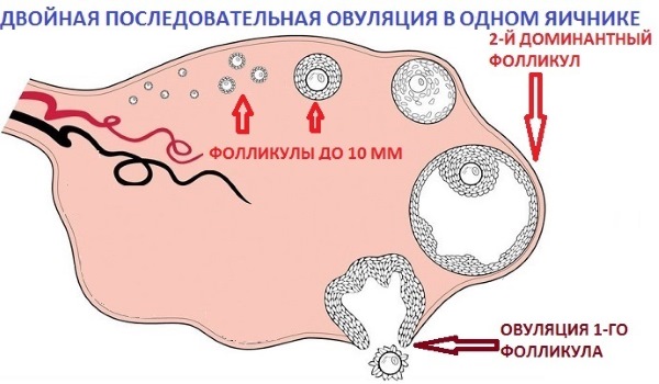 Можно ли забеременеть во время месячных, после, перед, в последний, первый, 2, 3 день, за неделю до. Как рассчитать вероятность