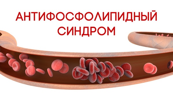 Мраморная кожа у грудничков. Причины, фото, лечение, что это значит