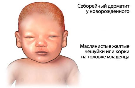 Мустела (Mustela) шампунь для детей всех возрастов. Отзывы, цена, состав