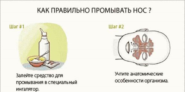 Чем лечить насморк при беременности. Капли, Звездочка, ингаляции, спрей, Мирамистин, алоэ, лук