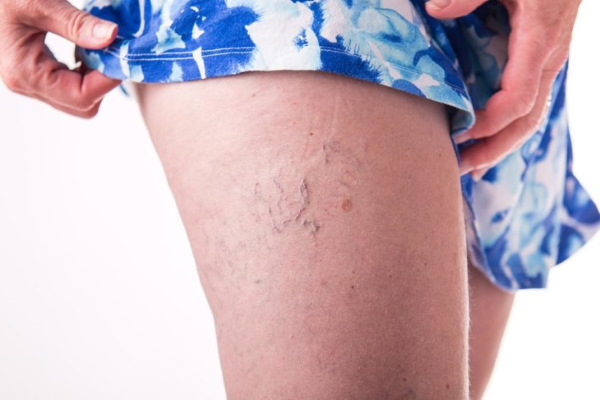 Недели беременности по месяцам, триместрам. Развитие плода, этапы