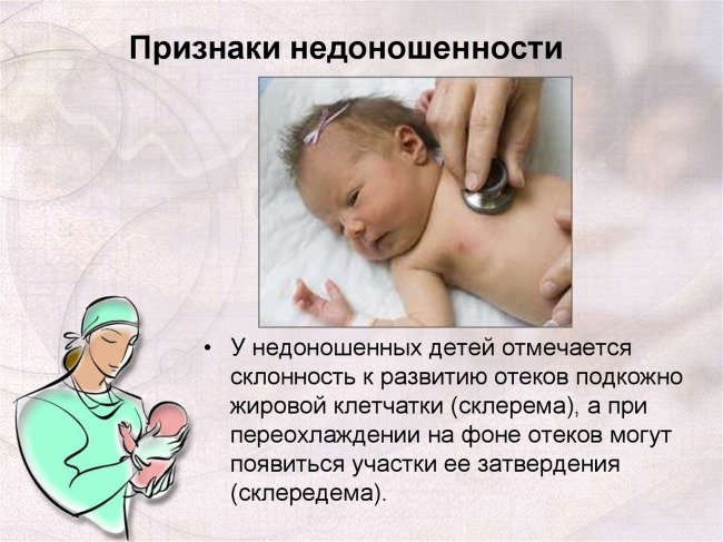 Недоношенные дети. Развитие по месяцам, этапы выхаживания, последствия в будущем. Уход, вскармливание, прикорм, массаж, одежда, прививки